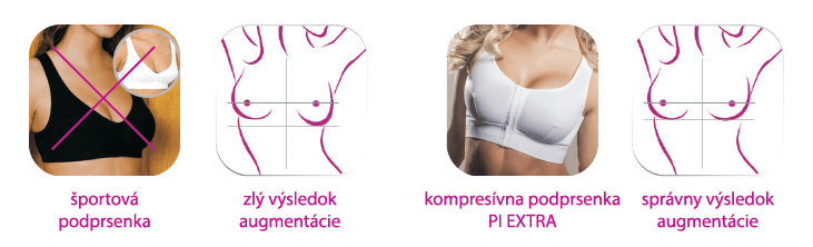 Siklienka - Pooperačné podprsenky - vysledok augumentacie